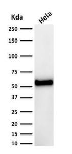 Anti-p53 Mouse Monoclonal Antibody [clone: DO-7]