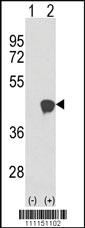 Anti-MAP2K1 Rabbit Polyclonal Antibody