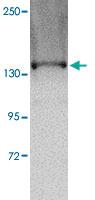 Anti-TTBK1 Rabbit Polyclonal Antibody