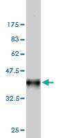 Anti-FHIT Mouse Monoclonal Antibody [clone: 1E3]