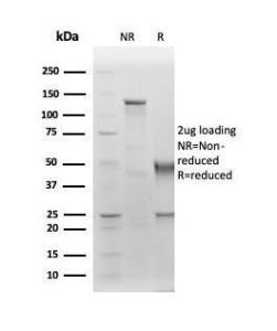 SDS-PAGE analysis of Anti-Albumin Antibody [ALB/6411R] under non-reduced and reduced conditions; showing intact IgG and intact heavy and light chains, respectively. SDS-PAGE analysis confirms the integrity and purity of the antibody