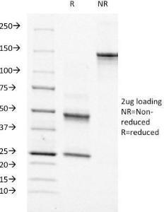 SDS-PAGE analysis of Anti-Moesin Antibody [MSN/491] under non-reduced and reduced conditions; showing intact IgG and intact heavy and light chains, respectively. SDS-PAGE analysis confirms the integrity and purity of the antibody.