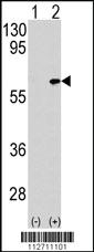 Anti-TAB1 Rabbit Polyclonal Antibody