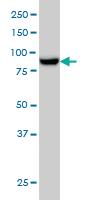 Anti-MAN1B1 Mouse Monoclonal Antibody [clone: 6B1]