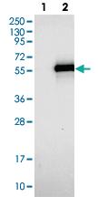 Anti-TWISTNB Rabbit Polyclonal Antibody