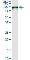 Anti-SOX13 Polyclonal Antibody Pair