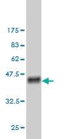 Anti-FHIT Mouse Monoclonal Antibody [clone: 3D3]