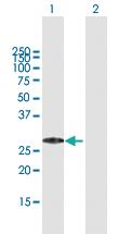 Anti-MED29 Mouse Polyclonal Antibody