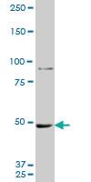 Anti-MTA1 Mouse Monoclonal Antibody [clone: 1C3]