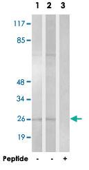 Anti-HOXA6 Rabbit Polyclonal Antibody