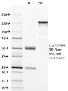 Anti-p53 Mouse Monoclonal Antibody [clone: DO-7]