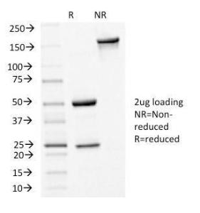 SDS-PAGE analysis of Anti-E Cadherin Antibody [4A2] under non-reduced and reduced conditions; showing intact IgG and intact heavy and light chains, respectively SDS-PAGE analysis confirms the integrity and purity of the antibody