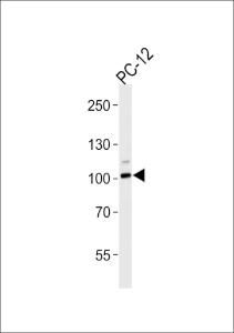 Anti-ATP1A1 Rabbit Polyclonal Antibody