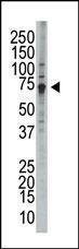 Anti-WEE1 Rabbit Polyclonal Antibody (AP (Alkaline Phosphatase))