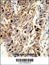 Anti-EFEMP1 Rabbit Polyclonal Antibody (FITC (Fluorescein Isothiocyanate))