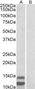 Anti-CDKN2B Antibody (A82648) (1µg/ml) staining of Human Gastrointestinal cancer lysate (35µg protein in RIPA buffer) with (B) and without (A) blocking with the immunizing peptide. Primary incubation was 1 hour. Detected by chemiluminescence.