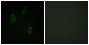 Immunofluorescence analysis of HepG2 cells using Anti-PKC-pan (phospho Thr497) Antibody. The right hand panel represents a negative control, where the antibody was pre-incubated with the immunising peptide.