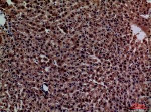 Anti-C Reactive Protein Rabbit Polyclonal Antibody