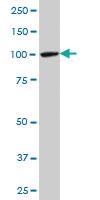 Anti-MTA1 Mouse Monoclonal Antibody [clone: 1C3]