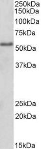 Anti-FOXC1 Antibody (A84156) (2 µg/ml) staining of HEK293 lysate (35 µg protein in RIPA buffer). Primary incubation was 1 hour. Detected by chemiluminescence