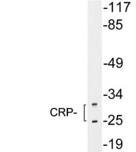 Western blot analysis of lysates from HeLa cells using Anti-CRP Antibody