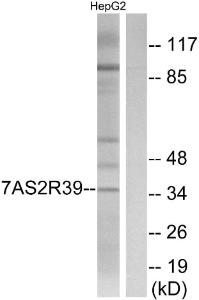 Antibody anti-TAS2R39 A99251-100 100 µg