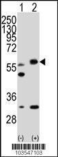 Anti-STK11 Rabbit Polyclonal Antibody (HRP (Horseradish Peroxidase))