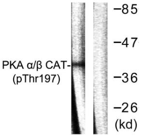 Western blot analysis of lysates from mouse brain using Anti-PKA CAT (phospho Thr197) Antibody. The right hand lane represents a negative control, where the antibody is blocked by the immunising peptide