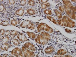 Anti-MAN1B1 Mouse Monoclonal Antibody [clone: 6B1]