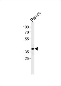 Anti-PHF11 Rabbit Polyclonal Antibody