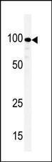 Anti-KSR1 Rabbit Polyclonal Antibody (Biotin)