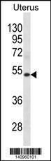 Anti-KRT72 Rabbit Polyclonal Antibody (AP (Alkaline Phosphatase))