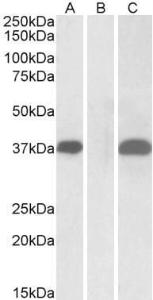 HEK293 lysate (10ug protein in RIPA buffer) overexpressing Human PIM2 with C-terminal MYC tag probed with Anti-PIM2 Antibody (A84158) (1µg/ml) in Lane A and probed with anti-MYC Tag (1/1000) in lane C. Mock-transfected HEK293 probed with Anti-PIM2 Antibody (A84158) (1mg/ml) in Lane B.