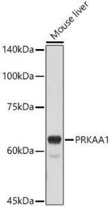 Western blot analysis of extracts of Mouse liver, using Anti-AMPK alpha 1 Antibody (A309813) at 1:500 dilution. The secondary antibody was Goat Anti-Rabbit IgG H&L Antibody (HRP) at 1:10,000 dilution.