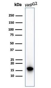 Western blot analysis of Hep2 cell line lysate using Anti-p16INK4a Antibody [CDKN2A/4844R]