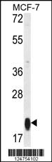 Anti-PEAK1 Rabbit Polyclonal Antibody