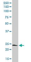 Anti-FADD Rabbit Polyclonal Antibody