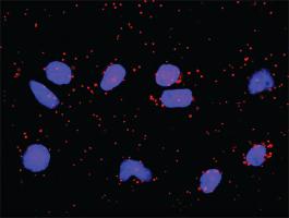 Anti-STAT5B + GHR Antibody Pair