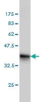 Anti-FHIT Mouse Monoclonal Antibody [clone: 3A5]