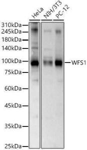 Anti-WFS1 Antibody (A11473)