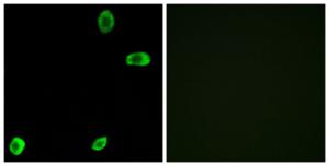 Antibody anti-TAS2R39 A99251-100 100 µg