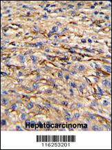 Anti-NES Rabbit Polyclonal Antibody