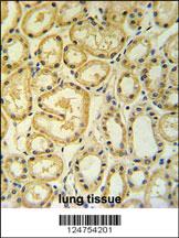 Anti-RT25 Rabbit Polyclonal Antibody