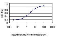 Anti-MAN1B1 Mouse Monoclonal Antibody [clone: 6B1]