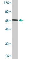 Anti-SDSL Mouse Monoclonal Antibody [clone: 1D6-6B8]