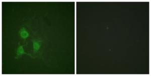 Immunofluorescence analysis of A549 cells using Anti-PKA CAT (phospho Thr197) Antibody. The right hand panel represents a negative control, where the antibody was pre-incubated with the immunising peptide