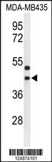 Anti-GPR17 Rabbit Polyclonal Antibody