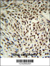 Anti-SNRPD3 Rabbit Polyclonal Antibody (Biotin)