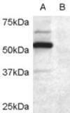 Anti-DCDC2 Antibody (A84162) (0.2 µg/ml) staining of COS7 cell lysate transfected with full length recombinant human DCDC2 (A) and untransfected control COS7 cells (B). Primary incubation was 1 hour. Detected by chemilu minescence