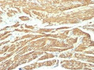 Immunohistochemical analysis of formalin-fixed, paraffin-embedded human uterus using Anti-Caldesmon Antibody [SPM168]